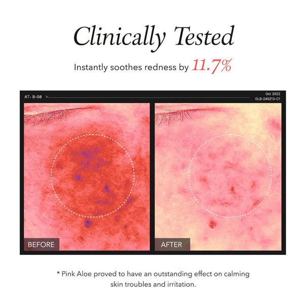 Pink Aloe Pack Cleanser (120g)