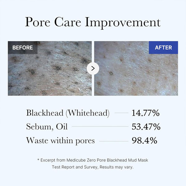 Zero Pore Blackhead Mud Mask (100g)